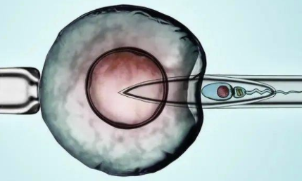 内膜5mm鲜胚移植