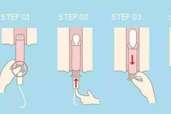 女性使用卫生棉条时动作需轻柔