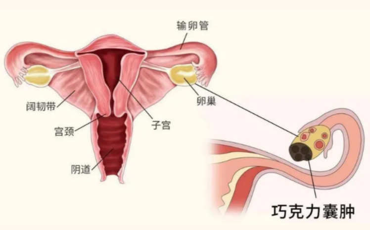 巧囊试管一次成功经验