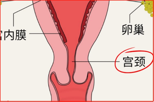 宫颈软化程度直接关系到分娩是否程度