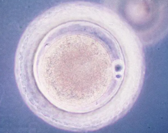 试管二胎移植囊胚前要做检查