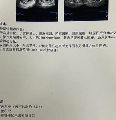 小周34岁首次试管鲜胚移植：第5天刺痛腰酸，第7天验孕成功着床