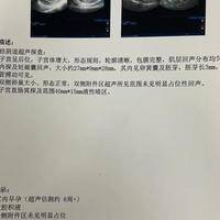 小周34岁首次试管鲜胚移植：第5天刺痛腰酸，第7天验孕成功着床