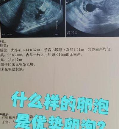 试管只有三个卵泡还要取吗，我的判断是先看这三个卵泡的来路