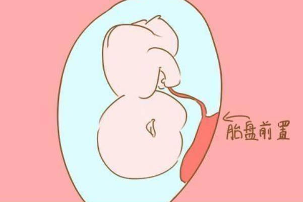 胎儿位于子宫前壁时孕妇没那么累