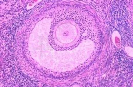 排出来的卵泡内裤图片