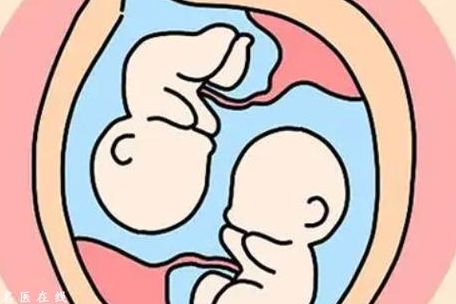 试管婴儿双生子几率高吗?我劝你先看这5个判断维度