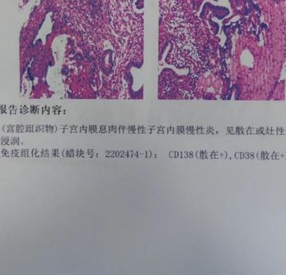 cd138阳性一定不能移植吗？答案可能和你想的不一样