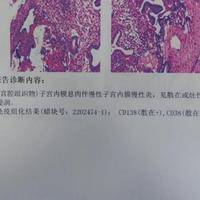 cd138阳性一定不能移植吗？答案可能和你想的不一样
