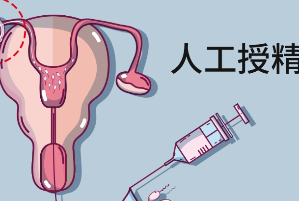 人工授精周期在1-2个月
