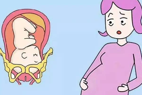 婴儿全入盆时孕妇肚子会明显下坠