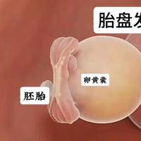 卵黄囊几周消失?别小看这个临时器官