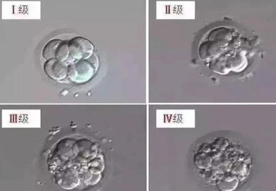 不同级别胚胎着床率有差异
