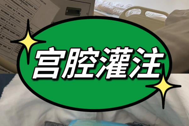 地域会影响宫腔灌注的费用