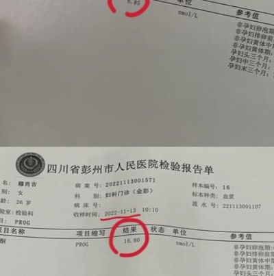 试管婴儿降调孕酮标准：不是越高越好，低于1才说明真压住了