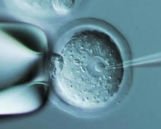 质量不好的鲜胚养囊可以移植