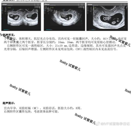 43岁苏姐试管三年：两次促排失败、三次移植，终于怀上双胞胎