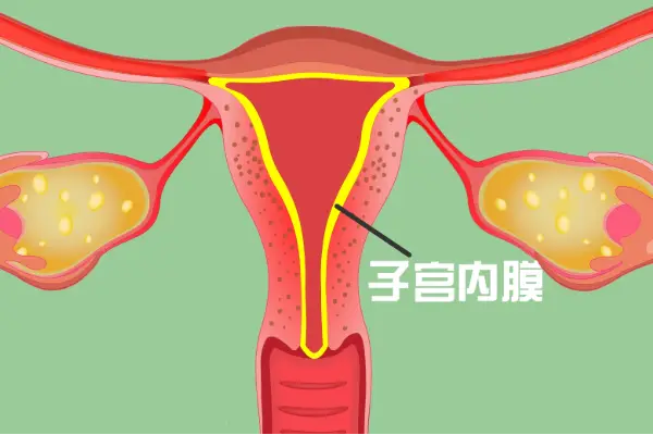 子宫内膜薄会导致空囊