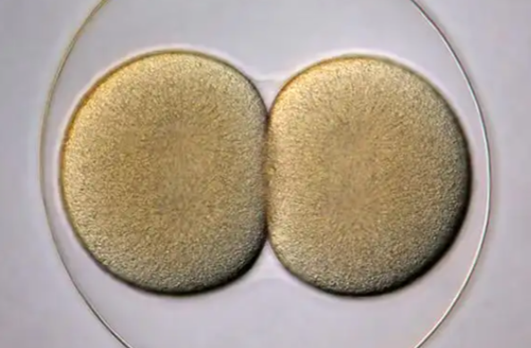 正常人慎用促排药怀双胞胎