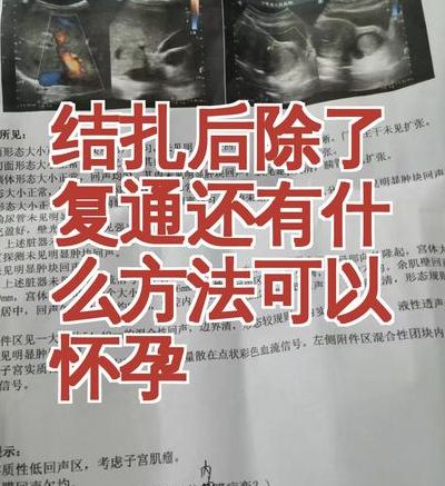 女人结扎了能做试管婴儿吗_能，但先别急着去复通