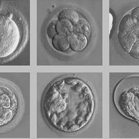 二代试管胚胎形态差异很大吗?