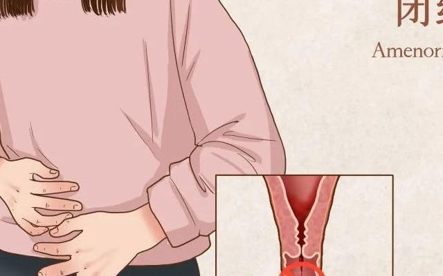 50岁绝经了可以做试管婴儿吗？先看这3步再决定