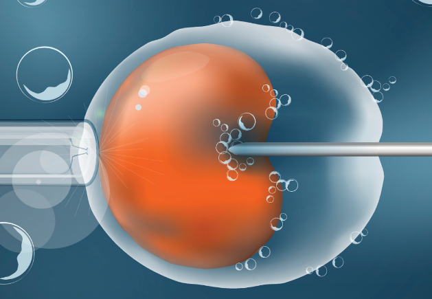 促排期间可以做针灸