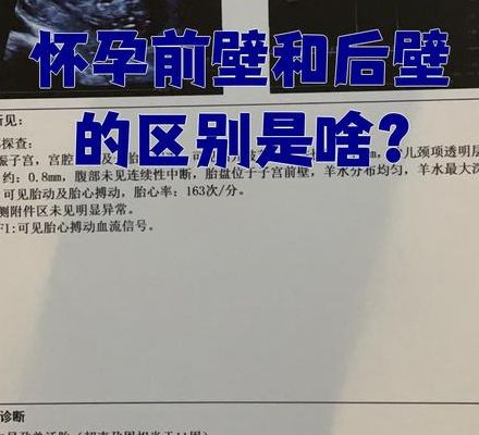 怀孕后壁和前壁有什么区别？前壁更显怀后壁藏肚，关键在胎盘位置
