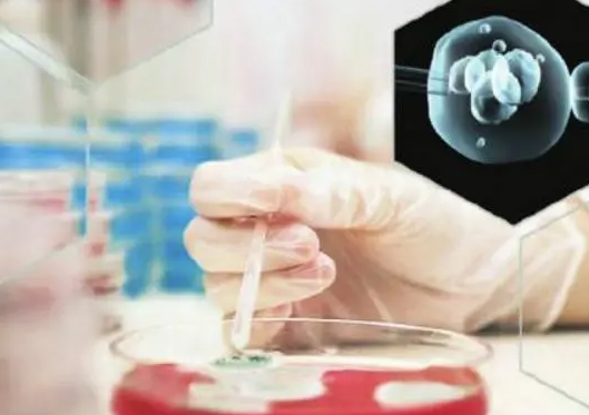美国试管胚胎筛查技术