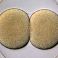 试管做双胞胎适合什么样的条件人?