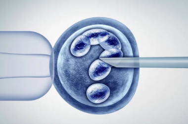 子宫内膜异位症的诱导排卵方案