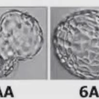 6AA囊胚和5AA囊胚哪个好?囊胚等级和成功率的关系