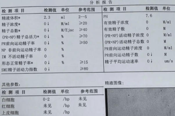 精子质量会影响怀孕的概率