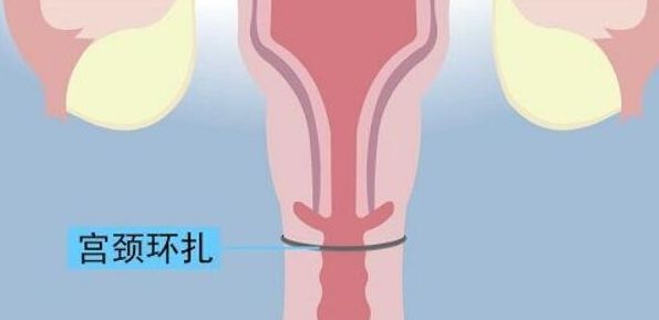 试管婴儿不能验血男女，PK孕后抽血查：别混为一谈
