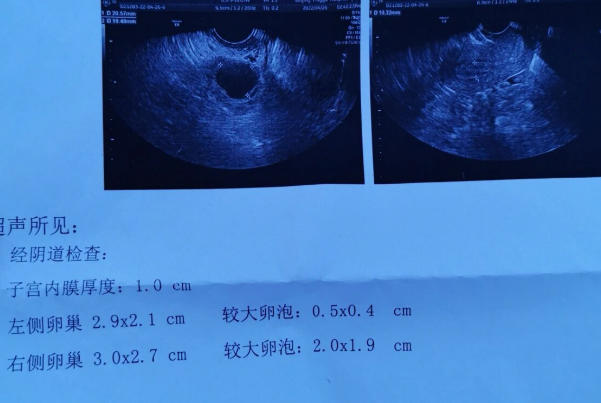 B超监测卵泡一般在上午