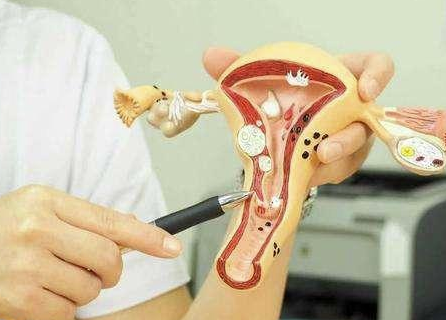 子宫肌瘤为什么会导致女性不孕，关键就在这！