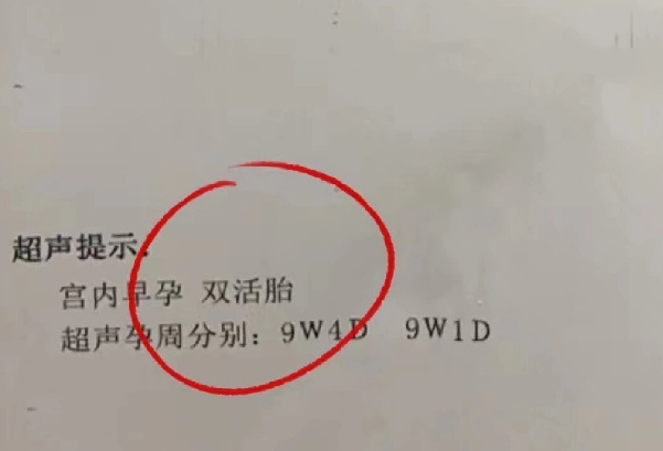 通常在怀孕8-12周可以确定是否怀双胞胎
