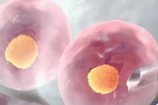 多囊卵泡不成熟可以做试管