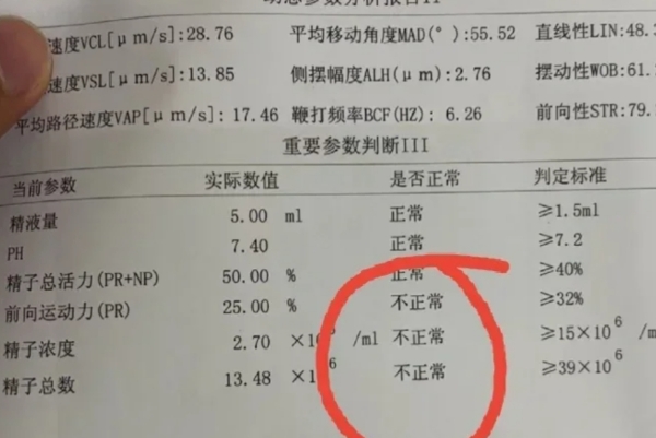 通过药物可以改善弱精症