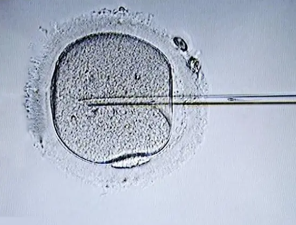 二级胚胎养囊成功率高