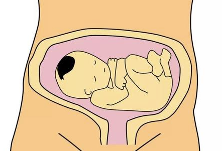 孕35周胎儿横位