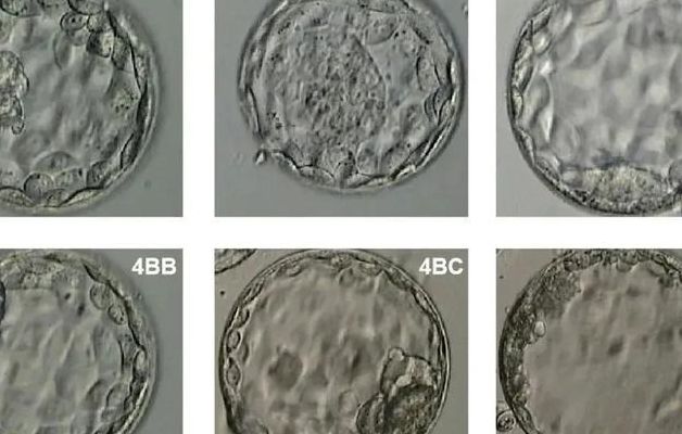 囊胚报告上4BB比4AA更常见，她养了8个胚胎才看懂