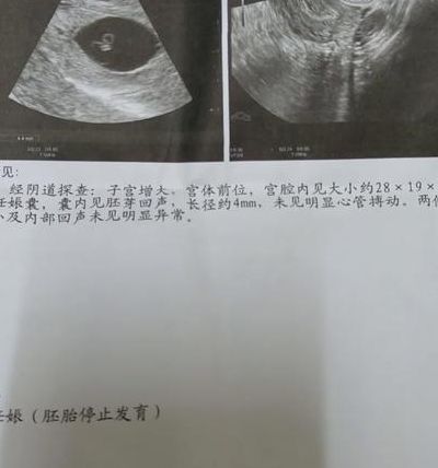 常州市妇幼保健院三代试管婴儿：两次胎停后，我查出了藏在染色体里的答案