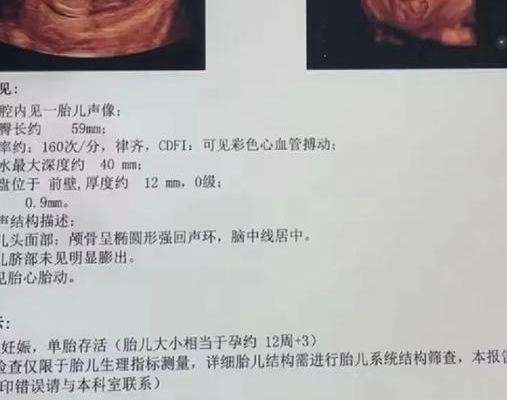 nt低于1.3一般是男孩吗 4个判断维度别急着下结论