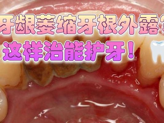 始基子宫优质治疗年龄：青春期早干预PK成年后再做？