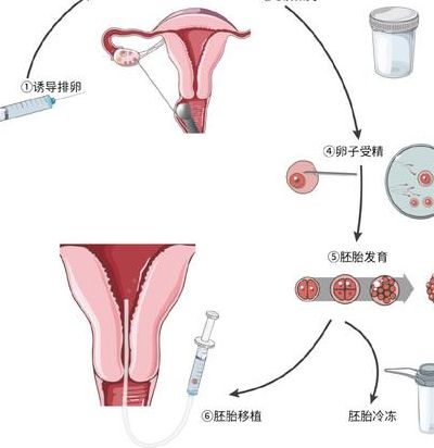 试管卵泡少只有2个怎么办？成功案例里都做对了这三步