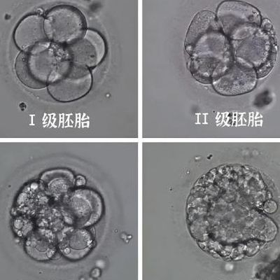 胚胎4aa和3aa的区别：级别高不等于胜算大
