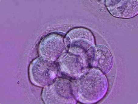 试管移植一枚4bb的囊胚生的孩子是不是很聪明?