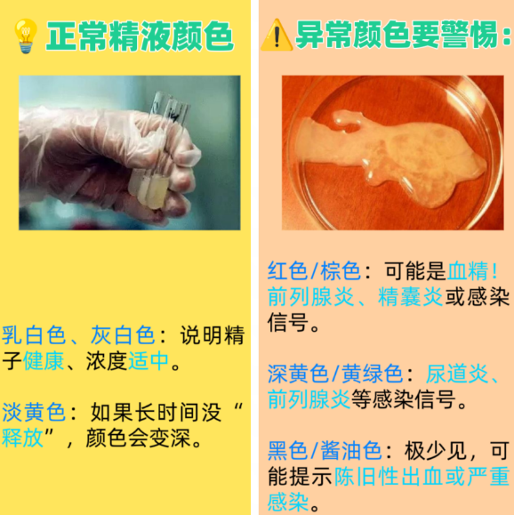 精子颜色正常参考值图