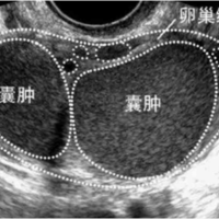 山东代生孩子孕山东省精子库在哪里,山东省精子库要求